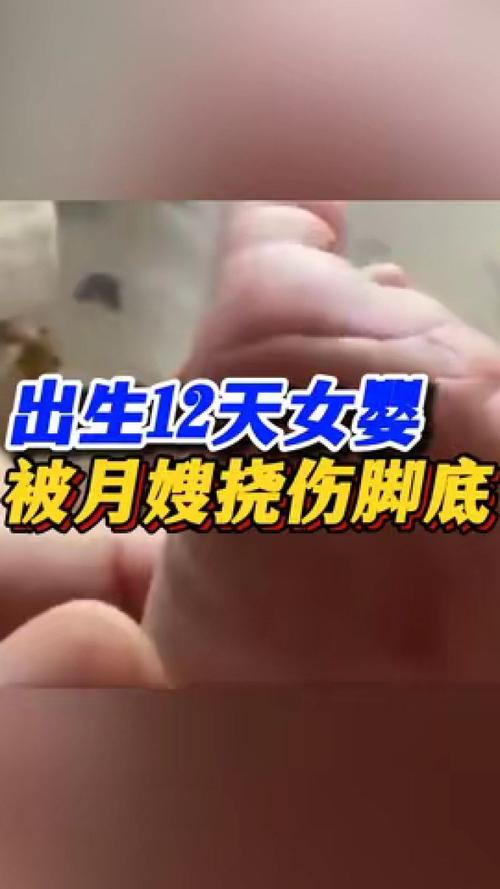 刚出生的宝宝，要怎么护理女婴被月嫂挠伤脚底视频女婴被月嫂挠伤脚底 补水